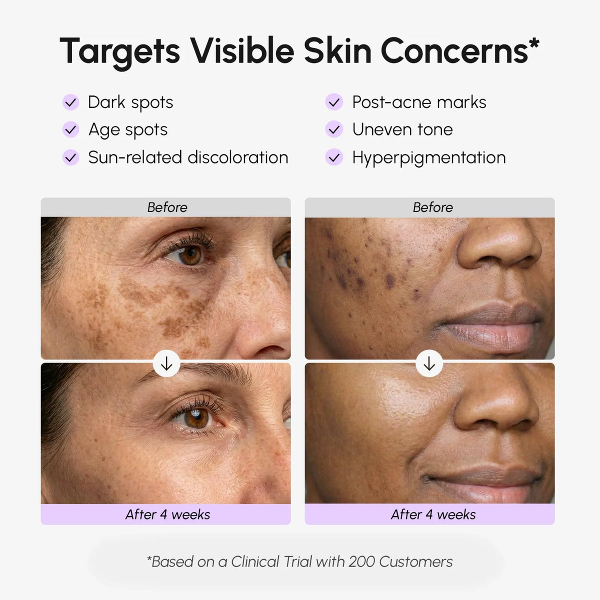 Marée® Dark Spot Correcting Serum | Brightening Hyperpigmentation Treatment
